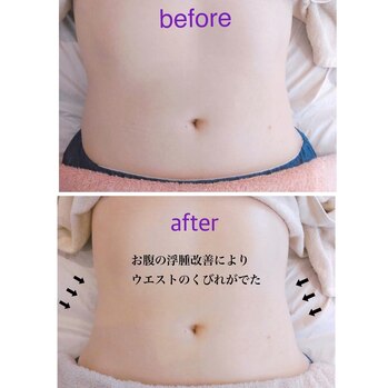 la soie（ラ ソワ）| 浜松市中央区菅原町 | 女性専用のリラクゼーションエステサロン | 疲労・むくみ改善・冷え性・血行促進など