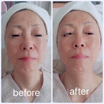 la soie（ラ ソワ）| 浜松市中央区菅原町 | 女性専用のリラクゼーションエステサロン | 疲労・むくみ改善・冷え性・血行促進など